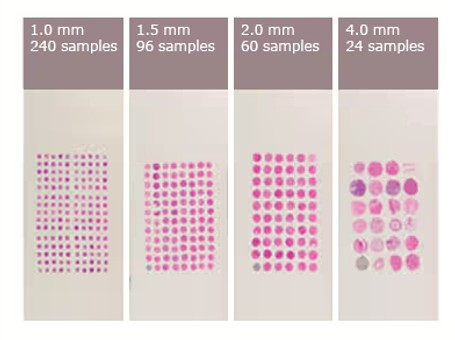 Tissue Microarray 예시